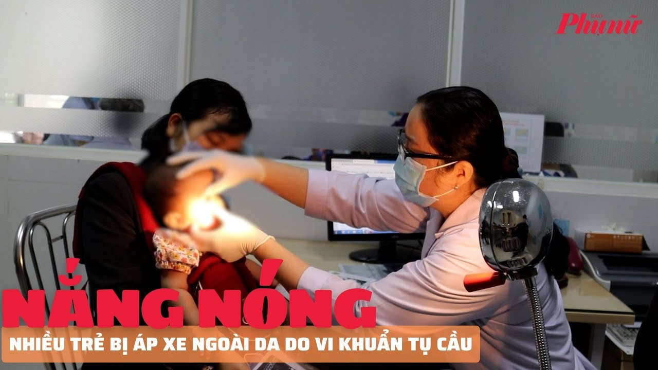 Nắng nóng, nhiều trẻ bị áp xe ngoài da do vi khuẩn tụ cầu | PNM